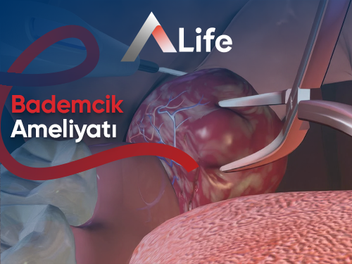 Bademcik Ameliyatı